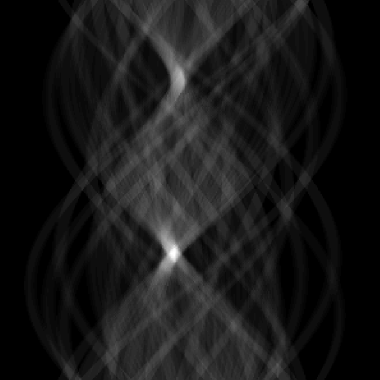 Transformada de Hough normal